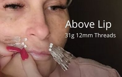 Above Lip | 31g 12mm Threads | Getglowingnowskincare.com