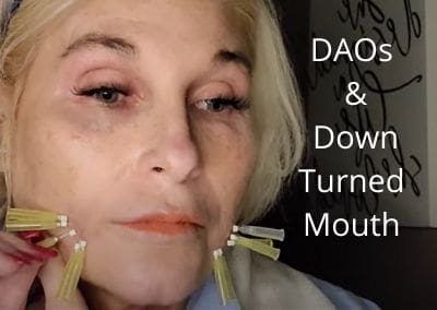 DAOs and Down Turned Mouth