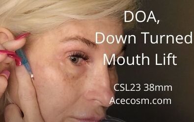 Quick DOA and Down Turned Mouth Lift | CSL23 38mm | Acecosm.com