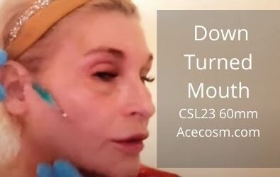 Fix Down Turned Mouth | CSL23 60mm Threads | Acecosm.com