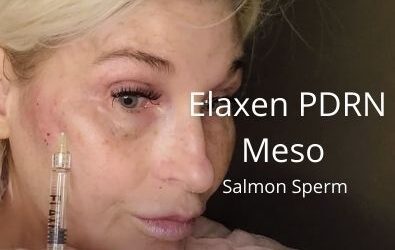 Elaxen PDRN Meso | Salmon Sperm | Acecosm.com DIY55