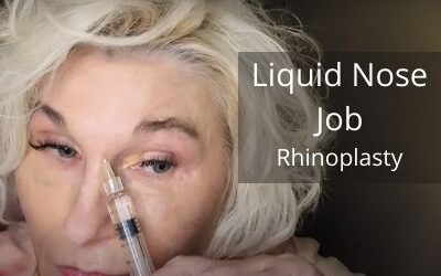 Liquid Nose Job – Rhinoplasty