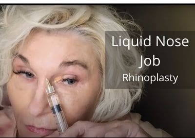 Liquid Nose Job – Rhinoplasty
