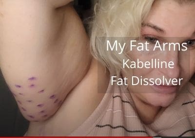 My Fat Arms | Kabelline – Fat Dissolver | Acecosm.com
