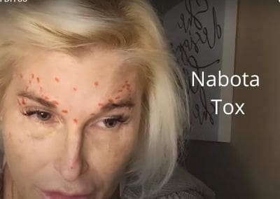 Nabota Tox from Acecosm