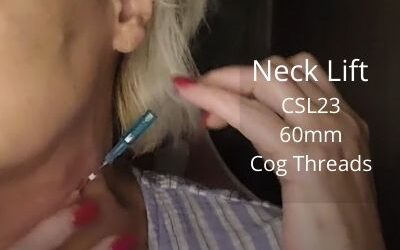 Neck Lift | CSL23 60mm Cog Threads | Acecosm