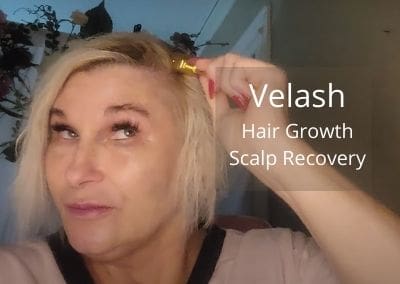 Velash | Hair Growth and Scalp Recovery | Acecosm.com