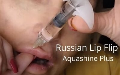 Russian Lip Flip with Aquashine Plus