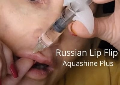 Russian Lip Flip with Aquashine Plus