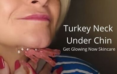 Turkey Neck – Under Chin | Get Glowing Now Skincare