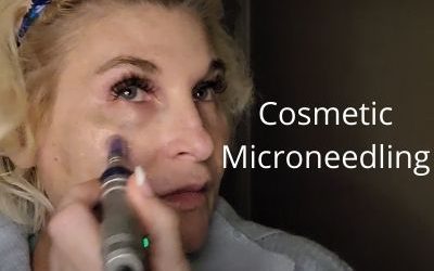 Cosmetic Microneedling – Dr. Pen