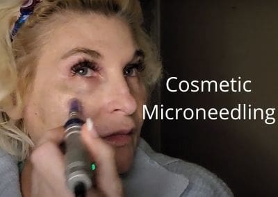 Cosmetic Microneedling – Dr. Pen