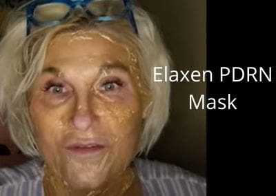 Elaxen PLLA Mask