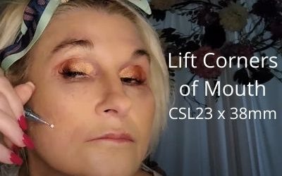 Lifting Down Turned Mouth – Corner Mouth Lift – PDO Cog Threads – CSL23 38mm