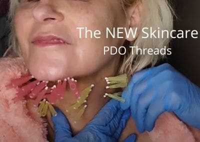 The New Skincare – PDO Threads