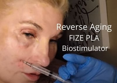 Reverse Aging with FIZE PLA a Biostimulator