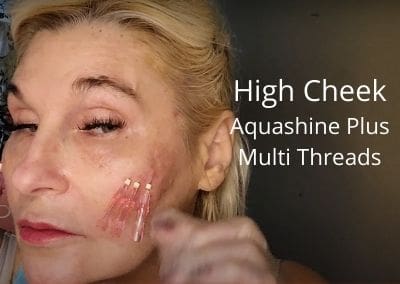 High Cheek – Aquashine and Multi Threads