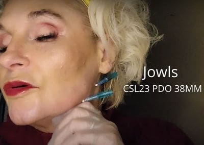 Jowls – CSL23 PDO 38MM