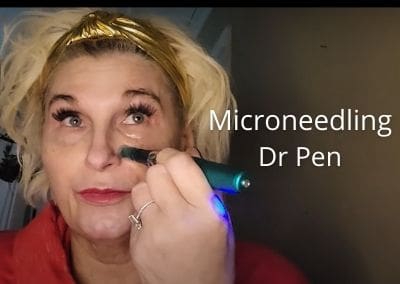 Microneedling with my New Dr. Pen