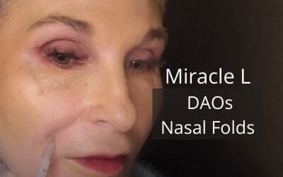 Miracle L – Meso – DAOs and Nasal Folds