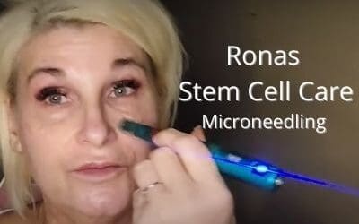 Ronas Stem Cell Care – Microneedle Mature skin