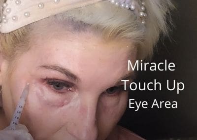 Miracle Touch Up – Eye Area