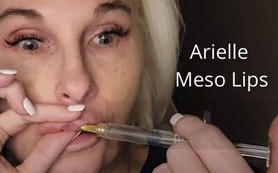Arielle Meso Lips
