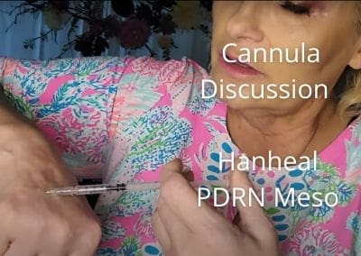 Cannula Discussion and Hanheal PDRN Meso