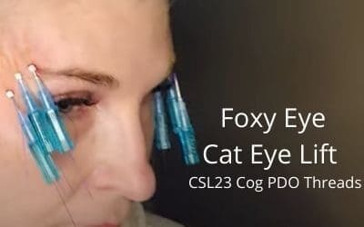 Foxy Eye – Cat Eye Lift – CSL23 Cog PDO Threads