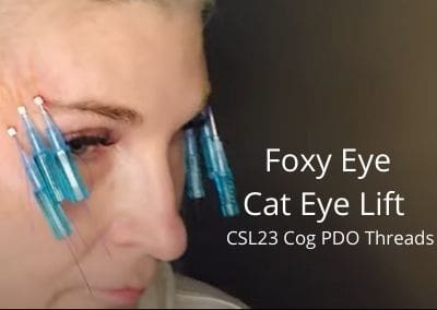 Foxy Eye – Cat Eye Lift – CSL23 Cog PDO Threads
