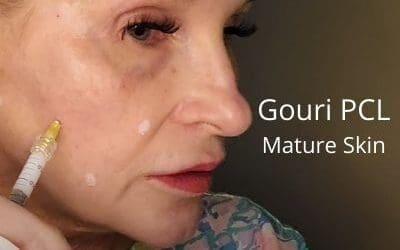 Gouri PCL – Treating Mature Skin