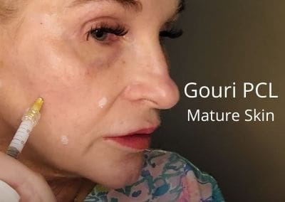 Gouri PCL – Treating Mature Skin