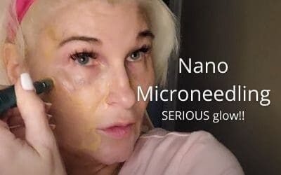 Nano Microneedling | How to needle at home for SERIOUS glow!!