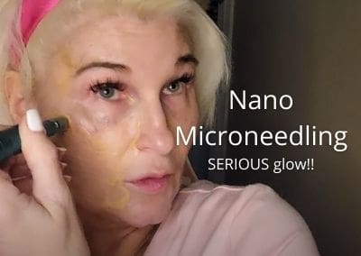 Nano Microneedling | How to needle at home for SERIOUS glow!!