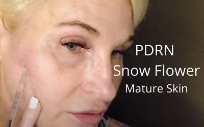 PDRN Snow Flower for Mature Skin