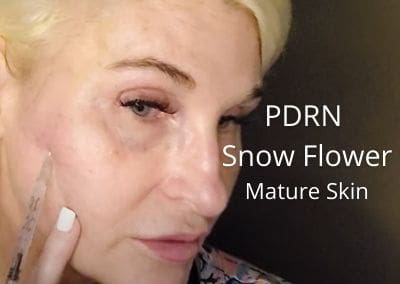 PDRN Snow Flower for Mature Skin