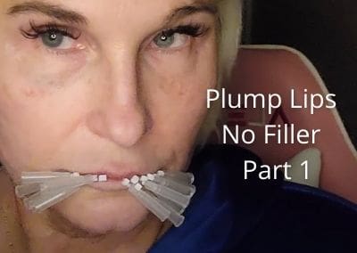 Plump Lips with No Filler – Part 1