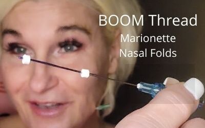 Boom Threads for Marionette Lines and Nasolabial Folds