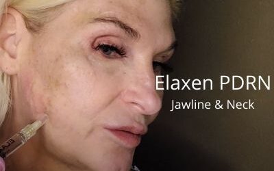 Elaxen PDRN – Meso for Jawline and Neck