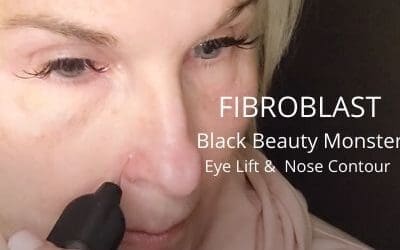 Eye Lift and Nose Contour – Fibroblast with Black Beauty Monster