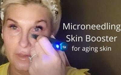Microneedling Skin Boosters for Aging Skin over 50