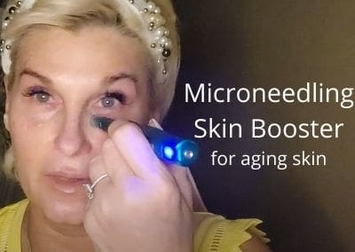 Microneedling Skin Boosters for Aging Skin over 50