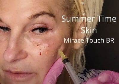 Summer Time Skin using Miracle Bright
