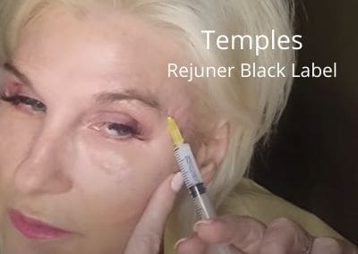 Temples – Rejuner Black Label – Biostimulator