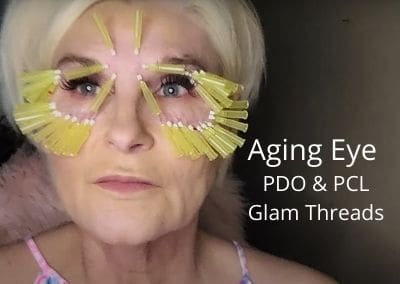 Aging Eye – PDO & PCL Glam Threads