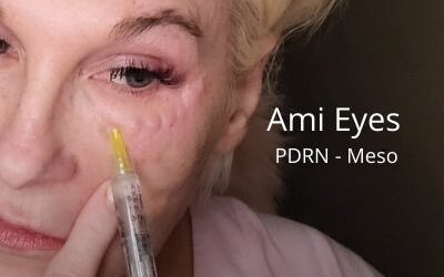 Ami Eyes PDRN – Meso