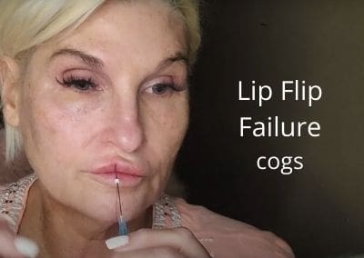 Lip Flip using CogThreads – Failure