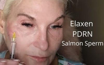 Elaxen PDRN – Salmon Sperm