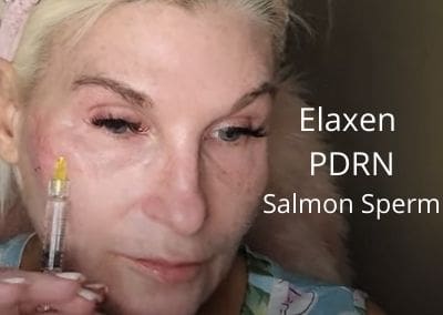 Elaxen PDRN – Salmon Sperm
