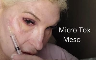 Micro Tox Meso – Benefits